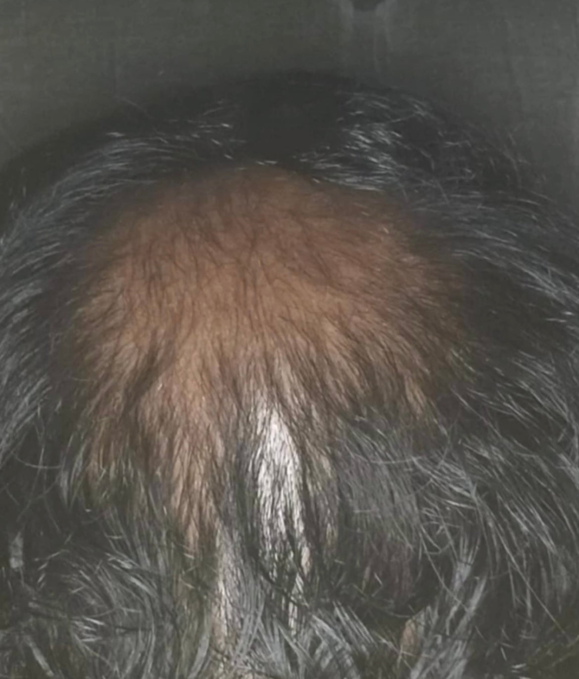 Hairs3crets 100% Pure Natural Growth Oil