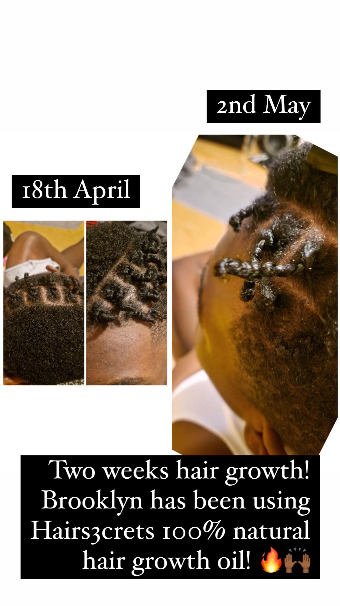 Hairs3crets 100% Pure Natural Growth Oil