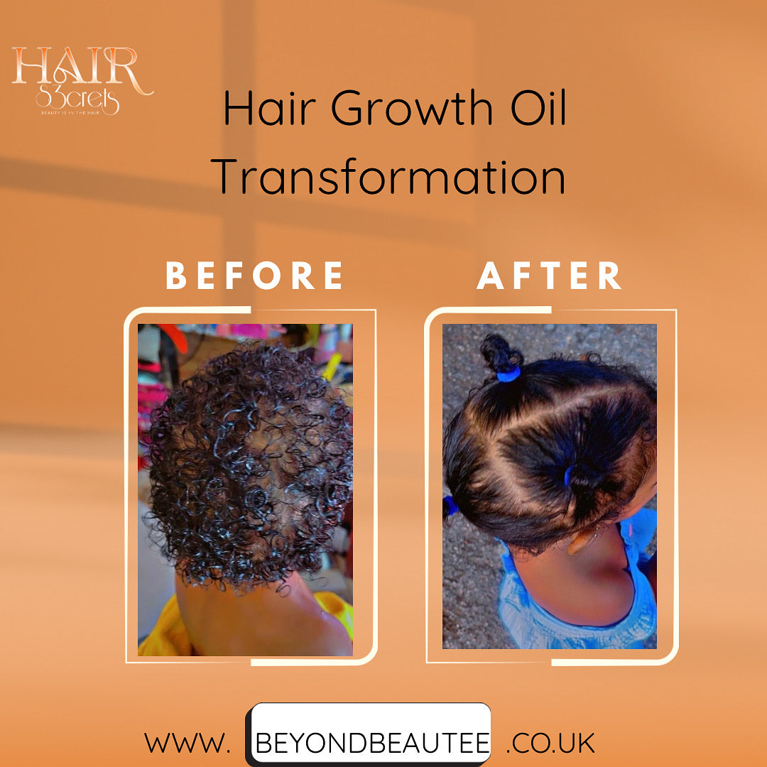 Hairs3crets 100% Pure Natural Growth Oil