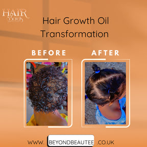 Hairs3crets 100% Pure Natural Growth Oil