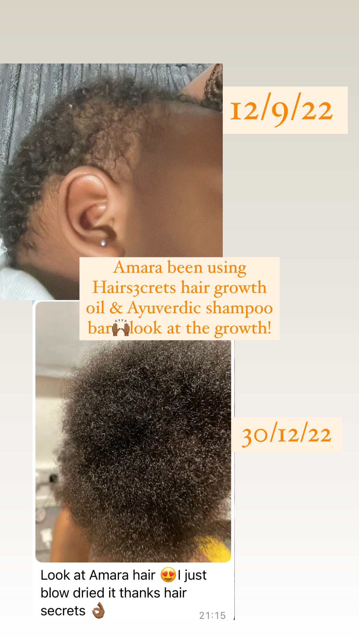 Hairs3crets 100% Pure Natural Growth Oil