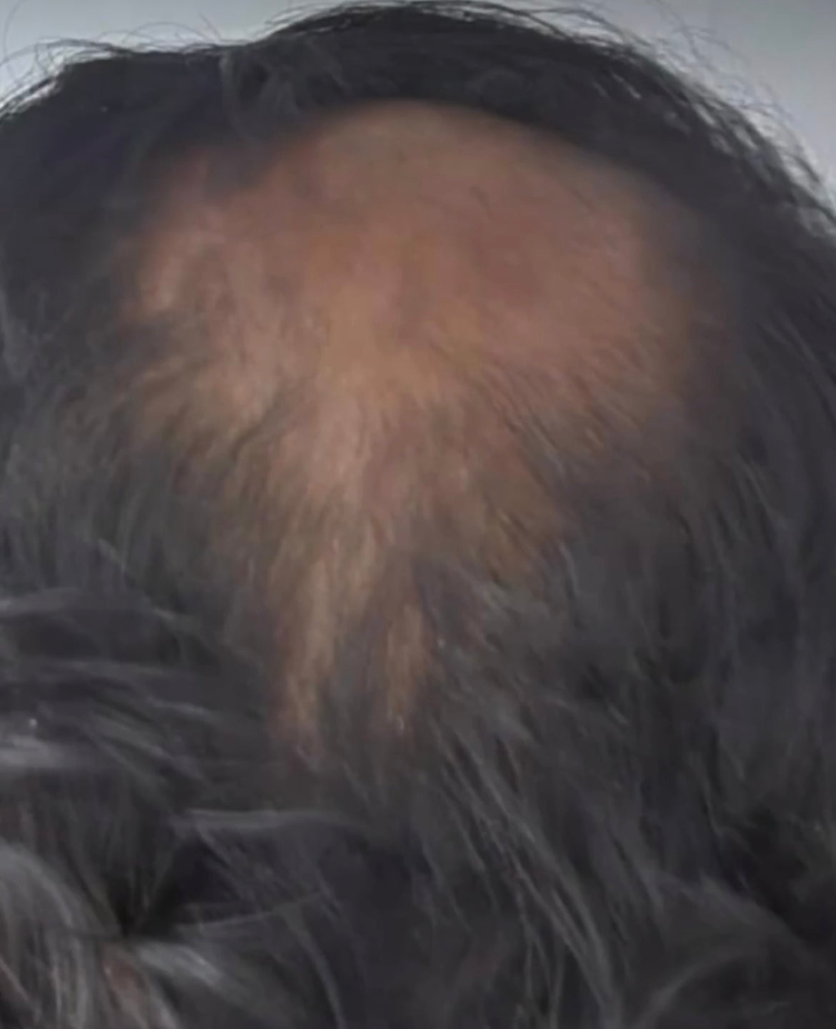 Hairs3crets 100% Pure Natural Growth Oil
