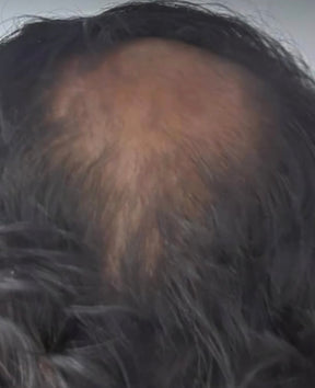 Hairs3crets 100% Pure Natural Growth Oil