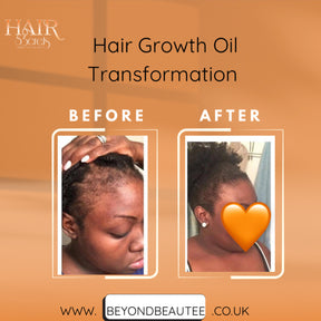 Hairs3crets 100% Pure Natural Growth Oil