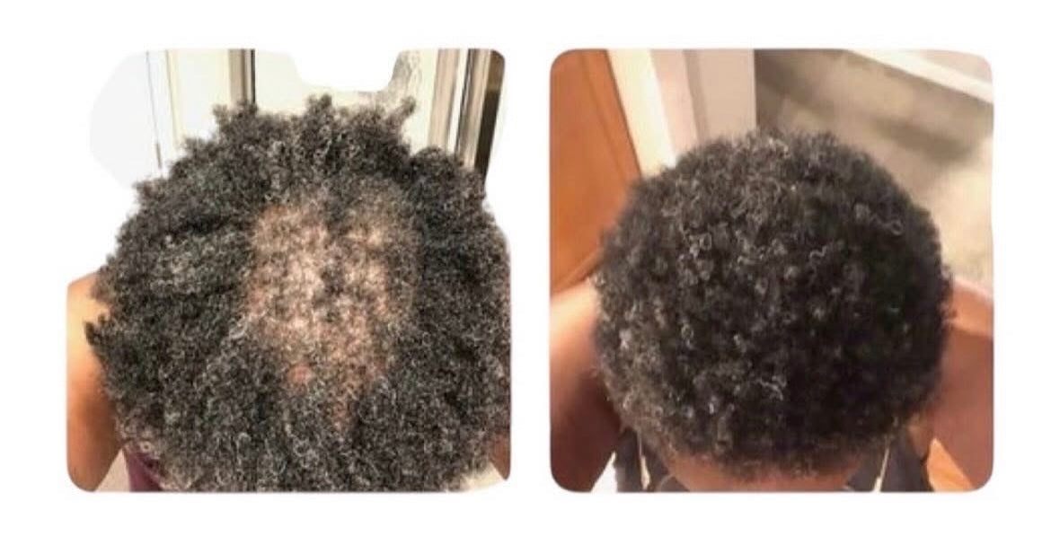 Hairs3crets 100% Natural Hair Growth Butter