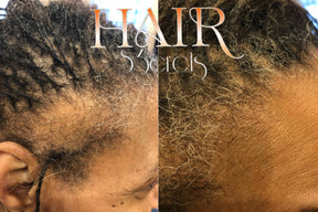 Hairs3crets Natural Hair Growth & Moisture Set.