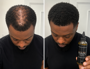 Hairs3crets 100% Pure Natural Growth Oil