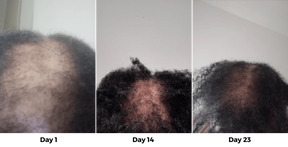 Hairs3crets 100% Pure Natural Growth Oil